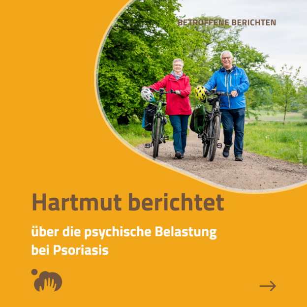 IG-Post: Hartmut berichtet: Psychische Belastung
