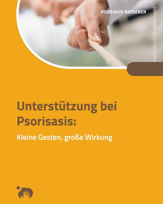 Unterstützung bei Psoriasis