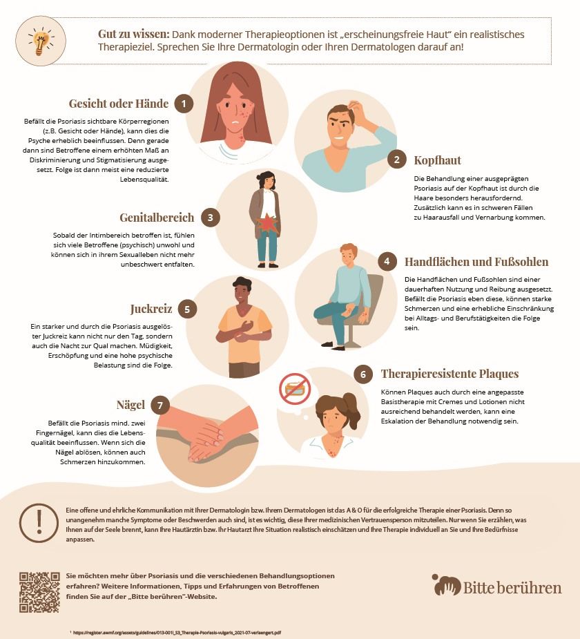 „Bitte berühren“-Infografik zu Upgrade-Kriterien bei Psoriasis